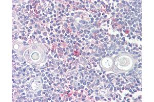 Anti-LITAF antibody IHC of human thymus. (LITAF Antikörper  (AA 51-64))