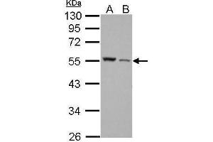 WB Image Desmin antibody detects DES protein by Western blot analysis. (Desmin Antikörper)