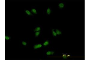 Immunofluorescence of monoclonal antibody to CSE1L on HeLa cell. (Exportin 2 Antikörper  (AA 872-971))
