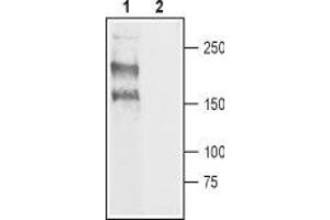 Western blot analysis of rat DRG lysate: - 1. (Nav1.8 Antikörper  (C-Term, Intracellular))