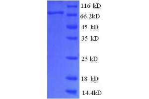 SDS-PAGE (SDS) image for alpha-Fetoprotein (AFP) (AA 19-605) protein (His tag) (ABIN5709005)