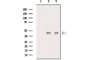 Western Blotting (WB) image for anti-Mitogen-Activated Protein Kinase 1/3 (MAPK1/3) antibody (ABIN6261598)