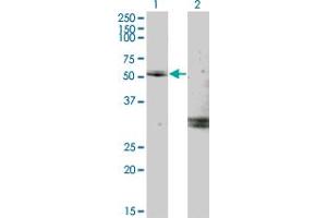 Western Blot analysis of MYOC expression in transfected 293T cell line by MYOC monoclonal antibody (M02), clone 2B4. (MYOC Antikörper  (AA 1-504))