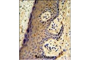 Forlin-fixed and paraffin-embedded hun skin reacted with FF Antibody (Center), which was peroxidase-conjugated to the secondary antibody, followed by DAB staining. (MafF Antikörper  (AA 66-92))