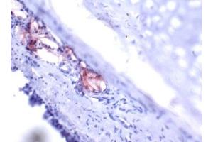 Immunohistochemistry (IHC) image for anti-Trefoil Factor 1 (TFF1) (AA 57-84), (C-Term) antibody (ABIN781662) (TFF1 Antikörper  (C-Term))