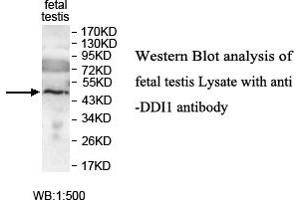 Image no. 1 for anti-DNA-Damage Inducible 1 Homolog 1 (DDI1) antibody (ABIN1576032) (DDI1 Antikörper)