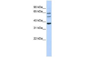 UGT1A9 antibody used at 1 ug/ml to detect target protein. (UGT1A9 Antikörper  (N-Term))