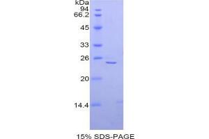 SDS-PAGE analysis of Mouse alpha Fodrin Protein. (SPTAN1 Protein)