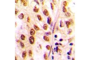 Immunohistochemistry (IHC) image for anti-Histone Deacetylase 2 (HDAC2) (C-Term) antibody (ABIN7303780)