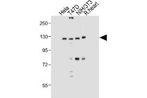 All lanes : Anti-Dnmt3a Antibody at 1:1000 dilution Lane 1: Hela whole cell lysate Lane 2: T47D whole cell lysate Lane 3: NIH/3T3 whole cell lysate Lane 4: Rat heart tissue lysate Lysates/proteins at 20 μg per lane. (DNMT3A Antikörper  (AA 457-486))