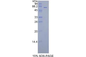 SDS-PAGE analysis of Rat FGL1 Protein. (FGL1 Protein)