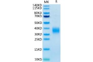 SDS-PAGE (SDS) image for Leukocyte-Associated Immunoglobulin-Like Receptor 1 (LAIR1) (AA 22-141) protein (His tag) (ABIN7275122)