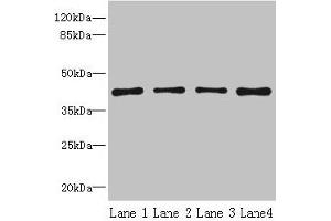Western blot All lanes: S1PR1 antibody at 2 μg/mL Lane 1: Jurkat whole cell lysate Lane 2: A375 whole cell lysate Lane 3: Mouse thymus tissue Lane 4: HepG2 whole cell lysate Secondary Goat polyclonal to rabbit IgG at 1/10000 dilution Predicted band size: 43 kDa Observed band size: 43 kDa (S1PR1 Antikörper  (AA 311-382))