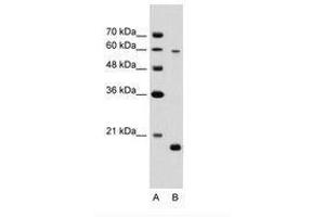Image no. 2 for anti-Solute Carrier Family 38 Member 4 (SLC38A4) (AA 381-430) antibody (ABIN203468)