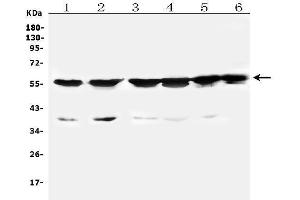 Western blot analysis of CYP2B6 using anti-CYP2B6 antibody (ABIN6719476).