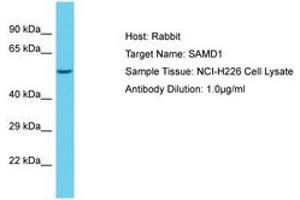 Image no. 1 for anti-Sterile alpha Motif Domain Containing 1 (SAMD1) (AA 434-483) antibody (ABIN6750543) (SAMD1 Antikörper  (AA 434-483))