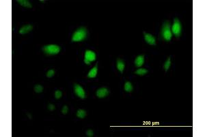 Immunofluorescence of purified MaxPab antibody to CRABP2 on HeLa cell. (CRABP2 Antikörper  (AA 1-138))