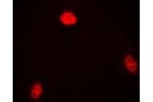 Immunofluorescent analysis of TARDBP staining in SW620 cells. (TARDBP Antikörper)