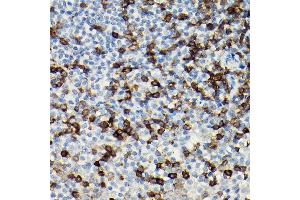 Immunohistochemistry of paraffin-embedded Human tonsil using CD3H antibody (ABIN3022812, ABIN3022813, ABIN3022814 and ABIN6219240) at dilution of 1:100 (40x lens). (CD247 Antikörper  (AA 50-164))