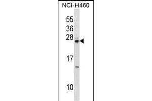 MOBKL3 Antibody (N-term) (ABIN1538807 and ABIN2848562) western blot analysis in NCI- cell line lysates (35 μg/lane). (MOBKL3 Antikörper  (N-Term))