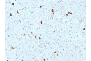 Formalin-fixed, paraffin-embedded human Cerebellum stained with Calretinin Mouse Monoclonal Antibody (CALB2/2602). (Calretinin Antikörper  (AA 23-242))