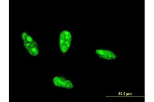 Immunofluorescence of monoclonal antibody to NHLH2 on HeLa cell.