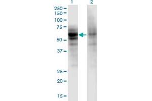 Western Blot analysis of DSTYK expression in transfected 293T cell line by DSTYK monoclonal antibody (M06), clone 1F9. (DSTYK Antikörper  (AA 80-189))