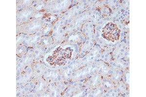 Immunohistochemistry of paraffin-embedded Mouse kidney using CD34 Polyclonal Antibody at dilution of 1:100 (40x lens). (CD34 Antikörper)