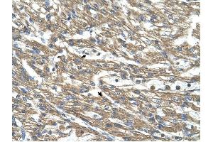 Cystathionase antibody was used for immunohistochemistry at a concentration of 4-8 ug/ml to stain Myocardial cells (arrows) in Human Head. (CTH Antikörper)
