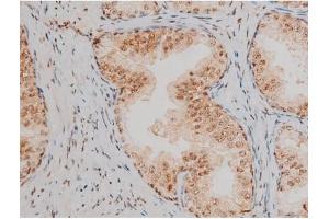 Immunohistochemistry (IHC) image for anti-Jun D Proto-Oncogene (JUND) (pSer255) antibody (ABIN6255135)