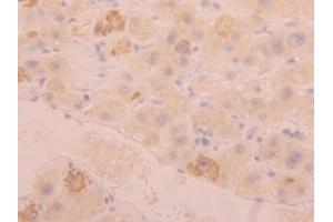 Detection of FGL1 in Human Liver Tissue using Polyclonal Antibody to Fibrinogen Like Protein 1 (FGL1) (FGL1 Antikörper  (AA 23-312))