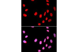 Immunofluorescence analysis of U2OS cells using CDC25C antibody. (CDC25C Antikörper)