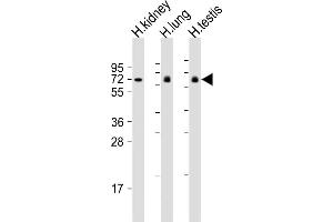 All lanes : Anti-LRRC1 Antibody (Center) at 1:2000 dilution Lane 1: human kidney lysate Lane 2: human lung lysate Lane 3: human testis lysate Lysates/proteins at 20 μg per lane. (LRRC1 Antikörper  (AA 298-330))