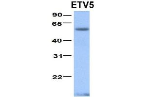 Host:  Rabbit  Target Name:  ETV5  Sample Type:  Human Fetal Heart  Antibody Dilution:  1. (ETV5 Antikörper  (N-Term))