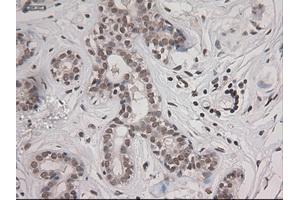 Immunohistochemical staining of paraffin-embedded breast using anti-STAT3 (ABIN2452542) mouse monoclonal antibody. (STAT3 Antikörper  (AA 154-175))