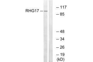 Western blot analysis of extracts from LOVO cells, using RHG17 antibody. (ARHGAP17 Antikörper)