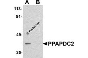 Western Blotting (WB) image for anti-Phosphatidic Acid Phosphatase Type 2 Domain Containing 2 (PPAPDC2) (C-Term) antibody (ABIN1030597) (PPAPDC2 Antikörper  (C-Term))