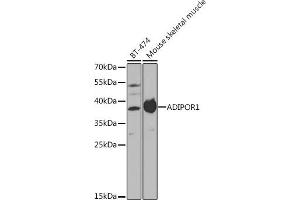 Western blot analysis of extracts of various cell lines, using  antibody (ABIN3022036, ABIN3022037, ABIN3022038 and ABIN6218580) at 1:1000 dilution. (Adiponectin Receptor 1 Antikörper  (AA 1-136))
