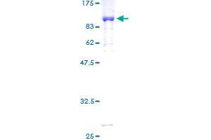 SMAD4 Protein (AA 1-552) (GST tag)