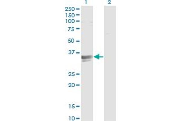 SFXN3 Antikörper  (AA 1-100)