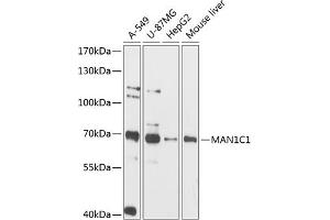Western blot analysis of extracts of various cell lines, using MC1 antibody (ABIN6131495, ABIN6143452, ABIN6143453 and ABIN6216608) at 1:3000 dilution.