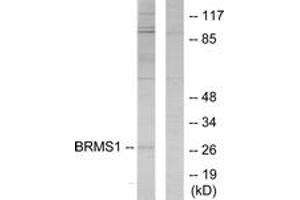 Western blot analysis of extracts from 293 cells, using BRMS1 Antibody.