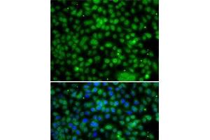 Immunofluorescence analysis of A-549 cells using PHYHD1 Polyclonal Antibody (PHYHD1 Antikörper)
