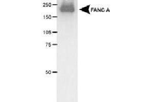 Western blot analysis of FANCA in transfected COS-1 cell lysate using FANCA polyclonal antibody .