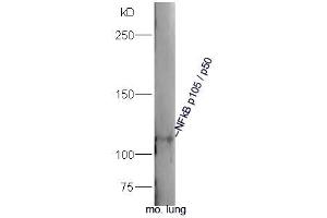 Mouse lung lysates probed with Rabbit Anti-NFkB p105/p50 Polyclonal Antibody, Unconjugated  at 1:300 overnight at 4˚C. (NFKB1 Antikörper  (AA 51-100))