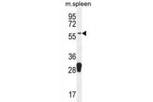 Western Blotting (WB) image for anti-Molybdenum Cofactor Synthesis 1 (MOCS1) antibody (ABIN2995584)