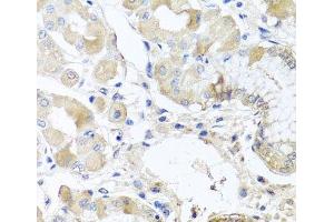 Immunohistochemistry of paraffin-embedded Human stomach using RPL36 Polyclonal Antibody at dilution of 1:100 (40x lens). (RPL36 Antikörper)