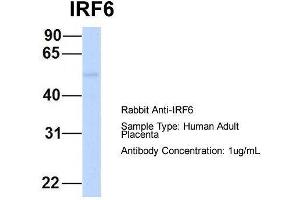 Host:  Rabbit  Target Name:  IRF6  Sample Type:  Human Adult Placenta  Antibody Dilution:  1. (IRF6 Antikörper  (Middle Region))