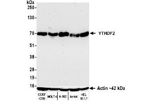 Western Blotting (WB) image for anti-YTH Domain Family, Member 2 (YTHDF2) (AA 300-350) antibody (ABIN7795702)