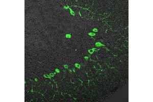 Immunohistochemistry (Paraffin-embedded Sections) (IHC (p)) image for anti-Inositol 1,4,5-Trisphosphate Receptor, Type 1 (ITPR1) (AA 2731-2749) antibody (ABIN1742253)